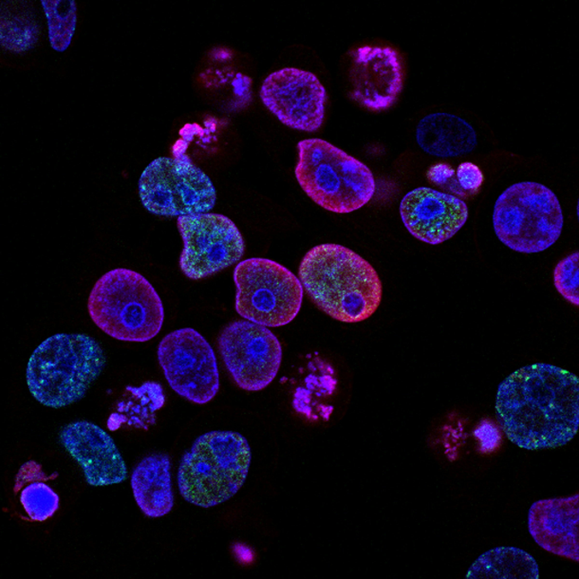Fluorescent cellular microscopy